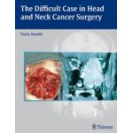 The Difficult Case in Head and Neck Cancer Surgery