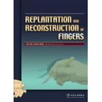 Replantation and Reconstruction of Fingers