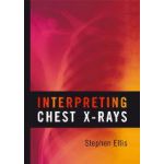 Interpreting Chest X-Rays