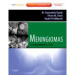 Meningiomas   Expert Consult - Online and Print