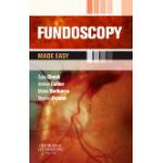 Fundoscopy Made Easy