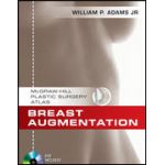 Breast Augmentation: An Operative Atlas with DVD