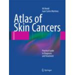 Atlas of Skin Cancers Practical Guide to Diagnosis and Treatment