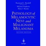 Pathology of Melanocytic Nevi and Malignant Melanoma