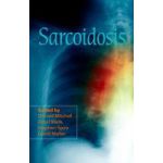 Sarcoidosis