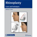 Rhinoplasty Cases and Techniques