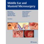 Middle Ear and Mastoid Microsurgery