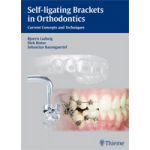 Self-ligating Brackets in Orthodontics Current Concepts and Techniques