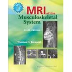 MRI of the Musculoskeletal System