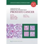 Advances in Surgical Pathology: Prostate Cancer