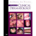 Atlas of Clinical Dermatology