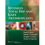 Revision Total Hip and Knee Arthroplasty