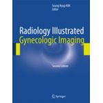 Radiology Illustrated: Gynecologic Imaging