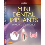 Mini Dental Implants: Principles and Practice