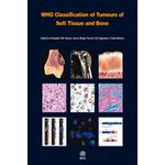 WHO Classification of Tumours of Soft Tissue and Bone