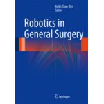 Robotics in General Surgery