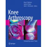 Knee Arthroscopy