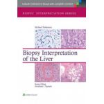 Biopsy Interpretation of the Liver