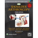 Shoulder Arthroscopy