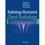 Radiology Illustrated: Chest Radiology