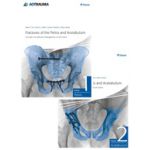 Fractures of the Pelvis and Acetabulum Principles and Methods of Management