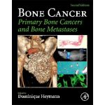 Bone Cancer Primary Bone Cancers and Bone Metastases