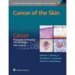 Cancer of the Skin CANCER: PRINCIPLES & PRACTICE OF ONCOLOGY