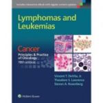 Lymphomas and Leukemias: CANCER: PRINCIPLES & PRACTICE OF ONCOLOGY