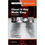 Chest X-Ray Made Easy