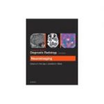 Grainger & Allison’s Diagnostic Radiology: Neuroimaging