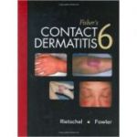 Fisher's Contact Dermatitis