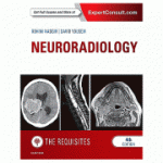 Neuroradiology: The Requisites