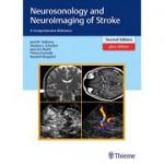 Neurosonology and Neuroimaging of Stroke A Comprehensive Reference