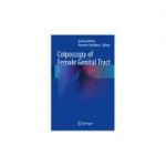 Colposcopy of Female Genital Tract