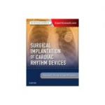 Surgical Implantation of Cardiac Rhythm Devices