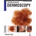 Color Atlas of Dermoscopy