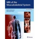 MRI of the Musculoskeletal System