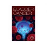 Bladder Cancer