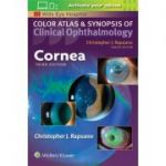 Cornea