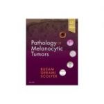 Pathology of Melanocytic Tumors