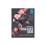 Andrews' Diseases of the Skin