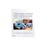 Trigger Point Dry Needling