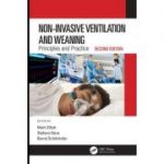 Non-Invasive Ventilation and Weaning: Principles and Practice