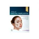 Atlas of Facial Implants