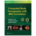 Computed Body Tomography with MRI Correlation