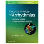 Electrophysiology of Arrhythmias
Practical Images for Diagnosis and Ablation