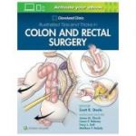 Cleveland Clinic Illustrated Tips and Tricks in Colon and Rectal Surgery