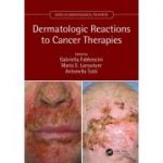 Dermatologic Reactions to Cancer Therapies