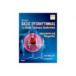 Huszar's Basic Dysrhythmias and Acute Coronary Syndromes: Interpretation and Management Text & Pocket Guide Package