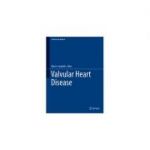 Valvular Heart Disease